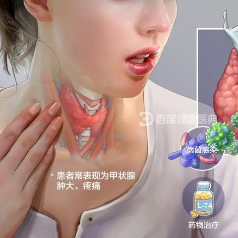 最新甲亢指南，全面解读治疗与管理策略